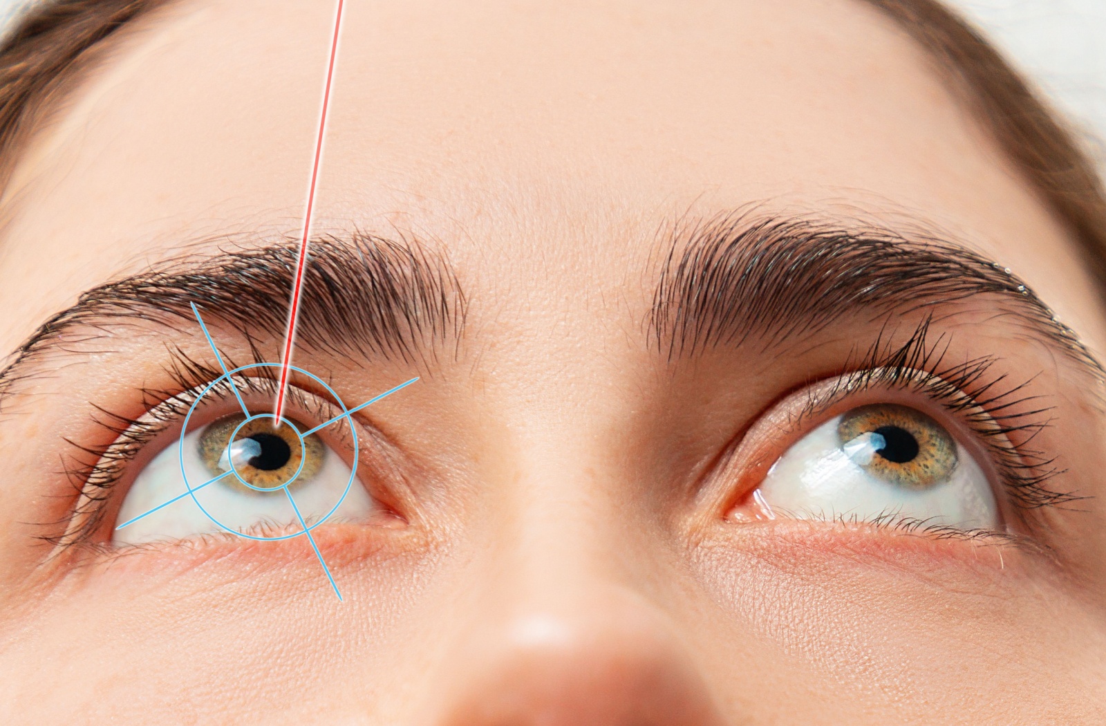 Close-up of a person's eyes with an illustration of where a laser would target the cornea during laser eye surgery procedure.